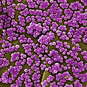 Staphylococcus aureus bacteria